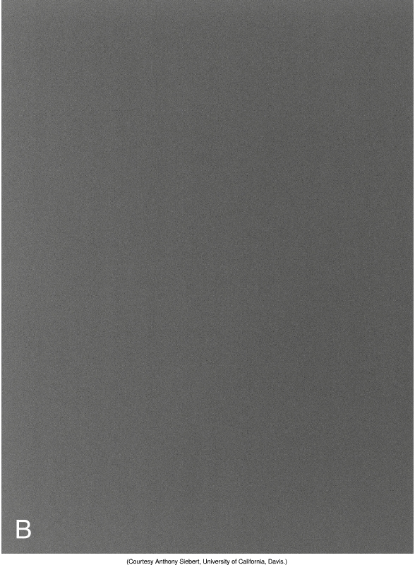 <p>A component of the pre-processing stage where the <strong>electronic noise</strong> within the system is evened out (eg. anode heel effect)</p>