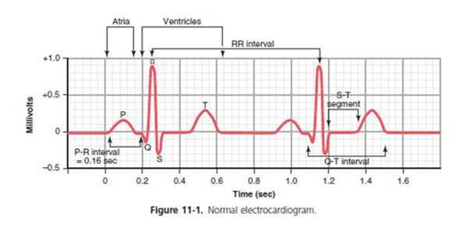 <p>The spread of depolarization through the atria.</p>
