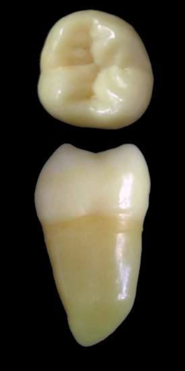 <p>what tooth is this &amp; why?</p>