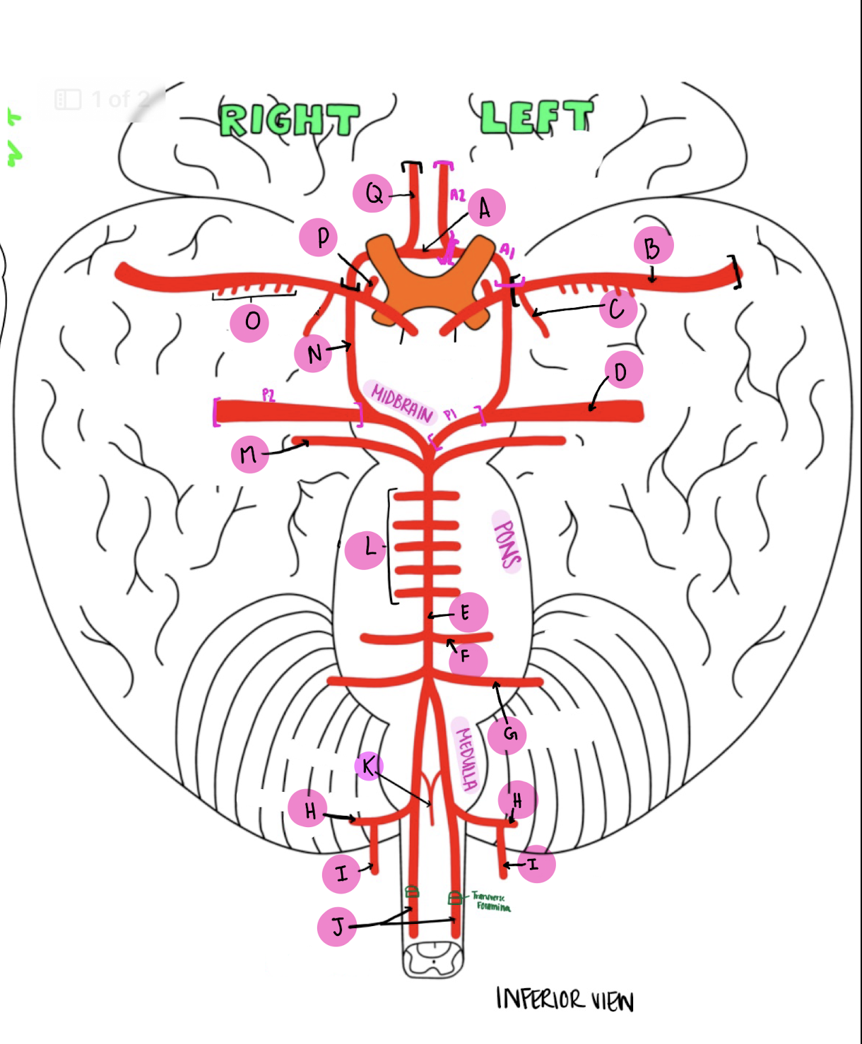 <p>What artery is labeled A?</p>