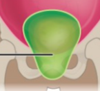 <p>What is the name of this Cavity? What group of cavities do they belong to?</p>