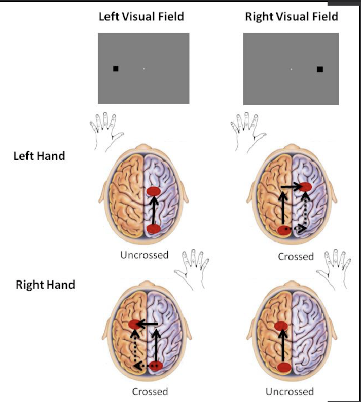 <p>Poffenberger paradigm</p>
