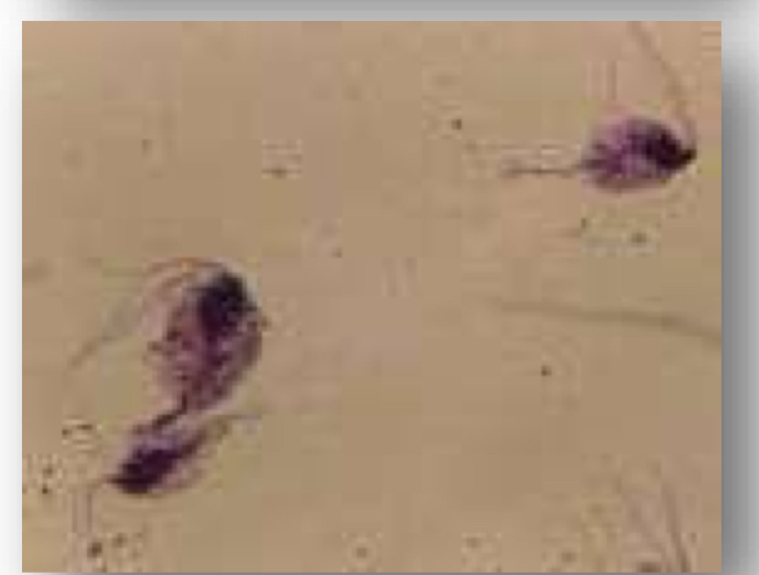 <p>Parasite?</p><p></p><p></p>