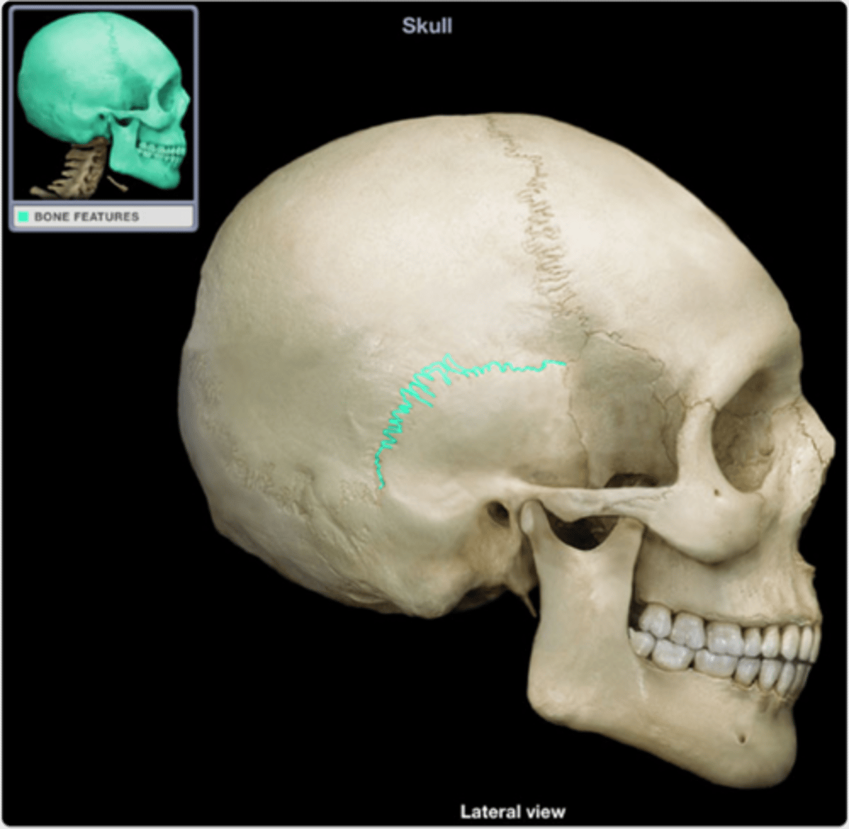 <p>junction</p><p>sutures on on both sides of the skull near the temporal bone.</p>