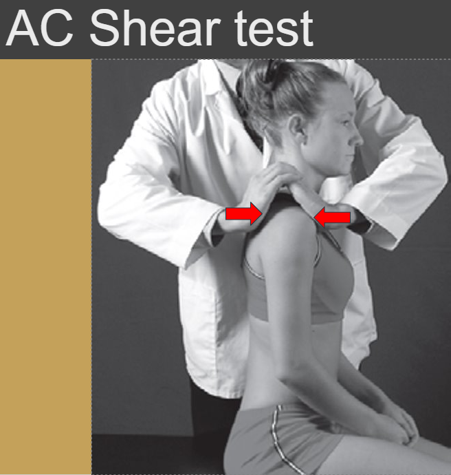 <p><strong>Purpose:</strong> To assess the AC joint dysfunction</p><p><strong>Steps:</strong></p><p>1.The client is seated or stands.</p><p>2.The therapist’s hands are cupped, the fingers interlaced with the base of one hand over the spine of the scapula and the other anteriorly over the clavicle.</p><p>3.The therapist squeezes the heels of the hands together.</p><p><strong>Positive</strong>:&nbsp; client reports pain or abnormal movement is detected in the AC joint.</p>