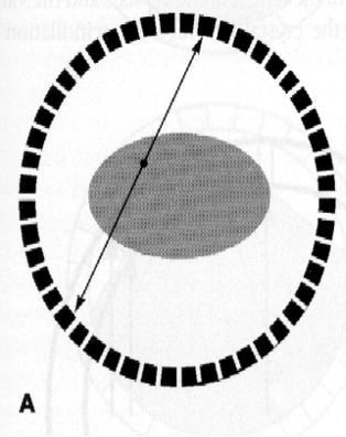 <p>This is an example of _____ coicidence</p>