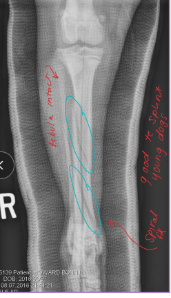 <ul><li><p><span style="background-color: transparent;"><strong><span>Why: </span></strong><span>Temp immobilization, support post-op, </span><em><u><span>definitive for mod </span></u></em><strong><em><u><span>stable</span></u></em></strong><em><u><span> fracture, money constraints </span></u></em></span></p><ul><li><p><span style="background-color: transparent;"><strong><u><span>No compression</span></u></strong><u><span> = </span></u><strong><u><span>not for swollen limbs</span></u></strong></span></p></li></ul></li><li><p><span style="background-color: transparent;"><strong><span>Types:</span></strong></span></p><ul><li><p><span style="background-color: transparent;"><strong><span>Distal limb: </span></strong><span>below elbow/stifle</span></span></p></li><li><p><span style="background-color: transparent;"><strong><span>Spica: </span></strong><span>proximal limb, extends to opposite hip/shoulder </span></span></p></li><li><p><span style="background-color: transparent;"><strong><span>Malleable: </span></strong><span>metal rods, thermoplastics, padded metal, cast tape</span></span></p></li><li><p><span style="background-color: transparent;"><strong><span>Rigid:</span></strong><span> preformed plastic/metal</span></span></p></li></ul></li><li><p><strong><u>Common complication: rub sores, monitor pressure points!!</u></strong></p></li></ul><img src="https://knowt-user-attachments.s3.amazonaws.com/d8a84405-5d97-443f-9760-997fb661bbd0.png" data-width="50%" data-align="center"><p></p>