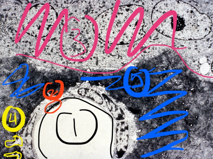 term image