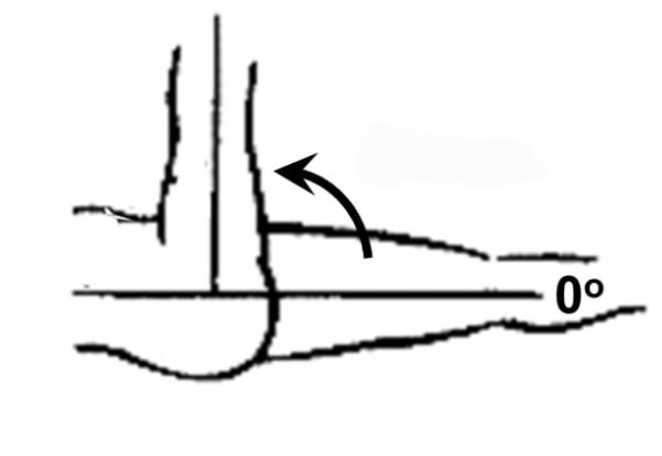 <p>Hip flexion</p>