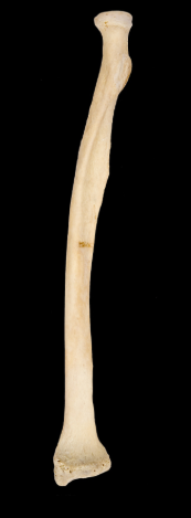 <p>left or right</p>