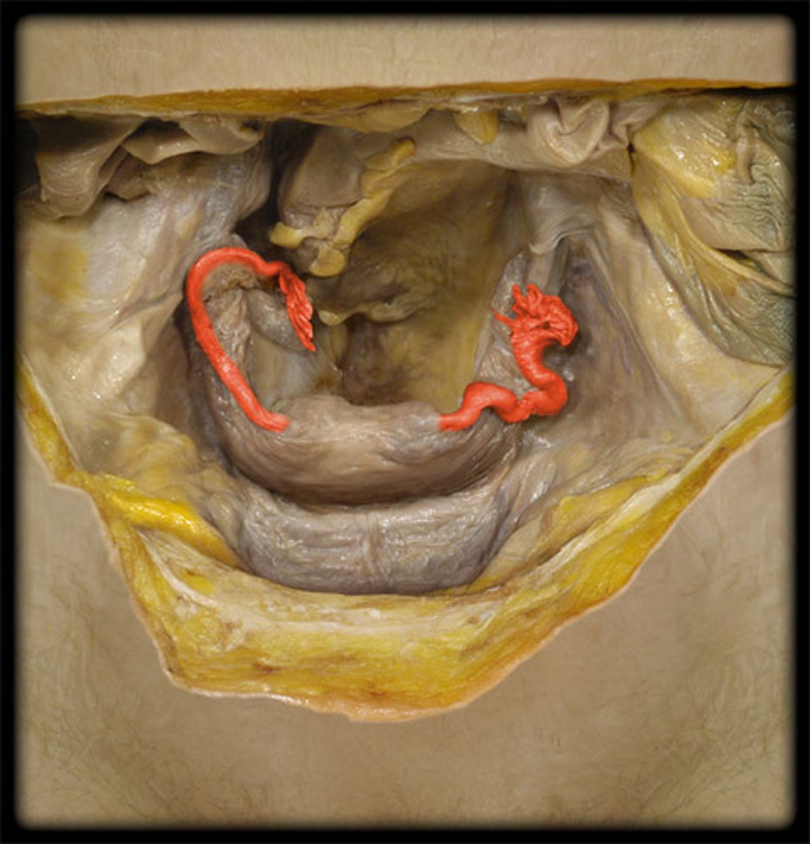 <p>Uterine tubes; transport a fertilized ovum to the uterus.</p><p>3 multiple choice options</p>