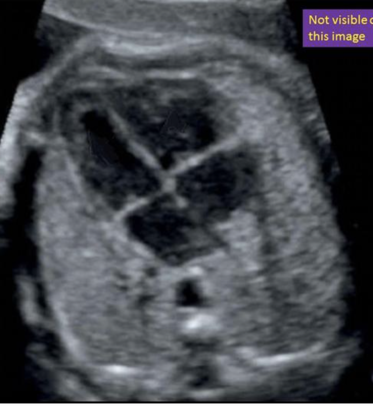 <p>where is the right atrium</p><ul><li><p>type “bottom right”</p></li></ul><p></p>