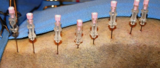 <p><span>Percutaneous laser disk ablation (PLDA)</span></p>