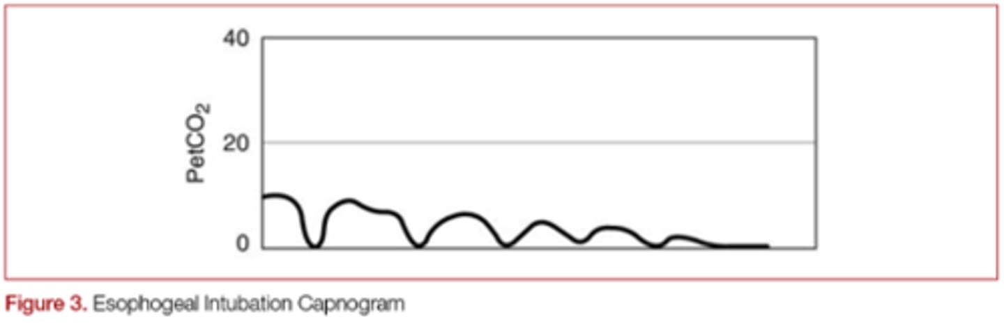 <p>EtCO2 diminishing over time</p>