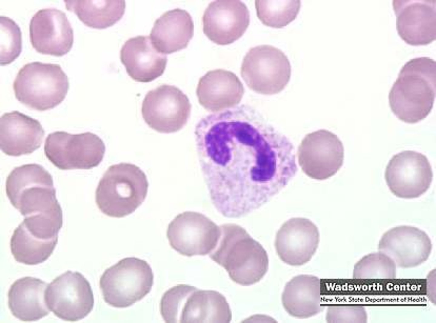 <p>Last stage of immaturity before becoming a mature granulocyte. These white blood cells have a horseshoe shaped nucleus</p>