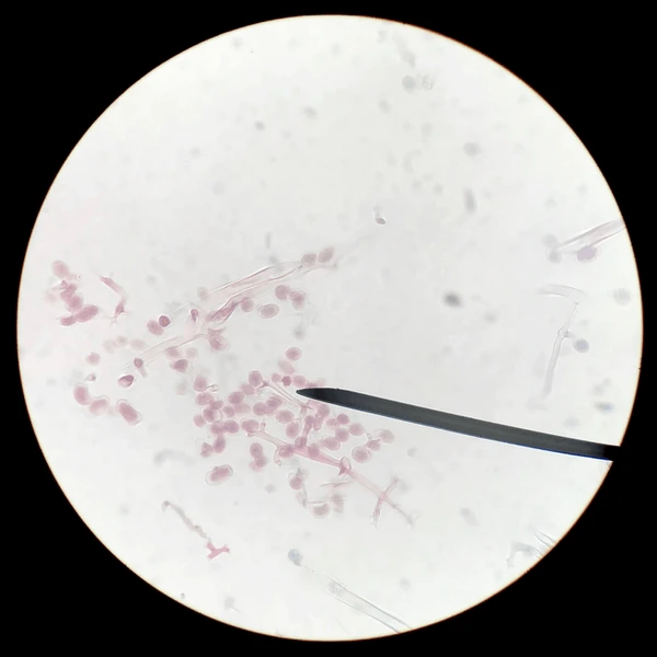 <p>What does this image show?</p>