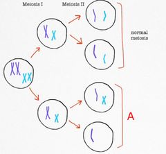 <p>Label the condition indicated by A in this diagram</p>