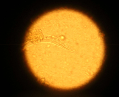 <p>what techniques can you use to diagnose <span style="color: rgb(255, 253, 253);"><span>Aelurostrongylus abstrusus</span></span></p>