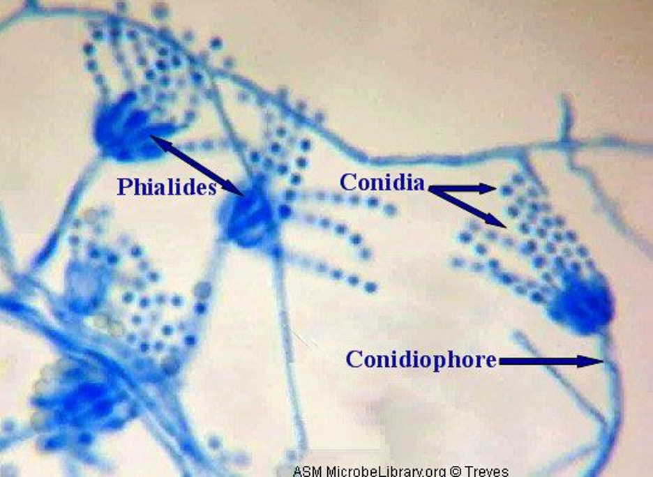 <p>Septate hyphae, branched conidiophores w/ secondary branches, flask shaped phialides w/ chains of round conidia</p>