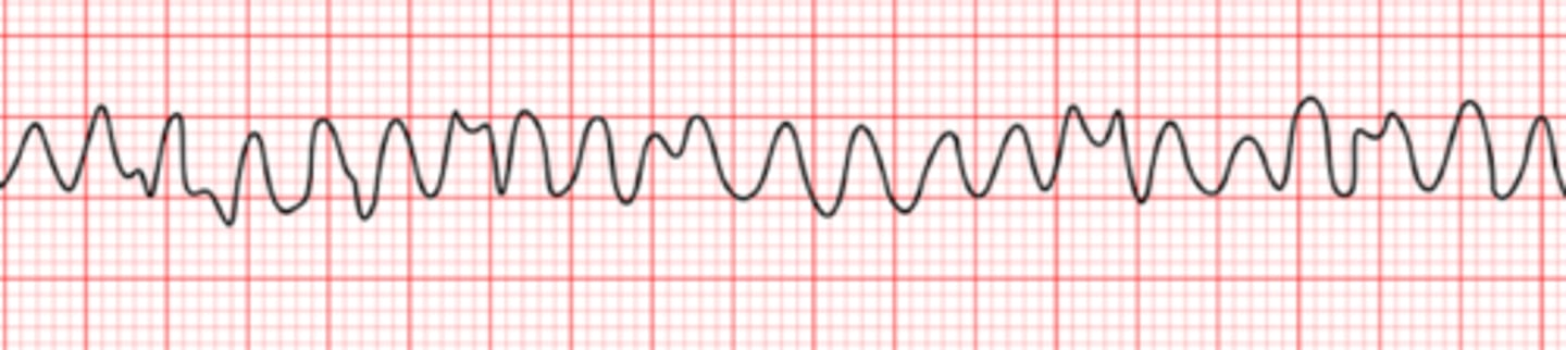 <p>Name the rhythm</p>