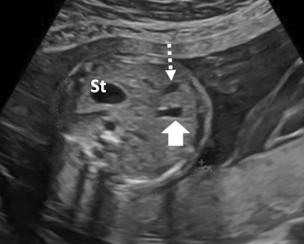 <p>what is the top arrow</p>