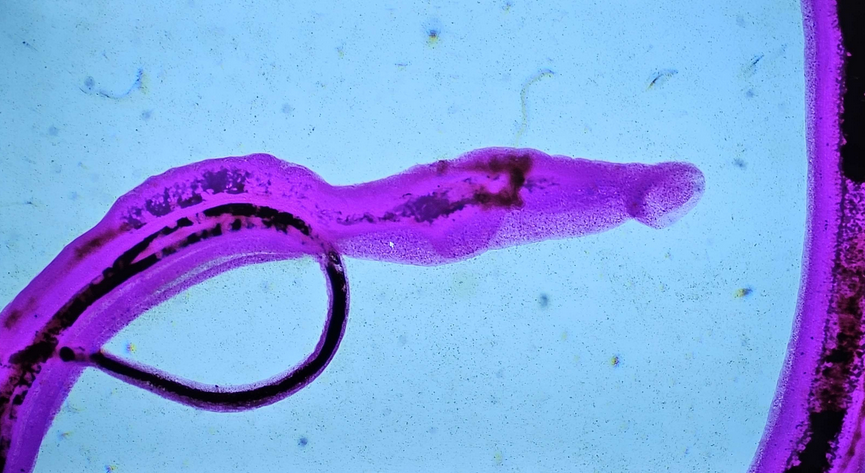 <p><span data-name="microscope" data-type="emoji">🔬</span><span data-name="petri_dish" data-type="emoji">🧫</span><strong><span> </span>Na podstawie zdjęcia preparatu:</strong></p><p></p><ul><li><p><span data-name="book" data-type="emoji">📖</span><span> </span>rozpoznaj gatunek pasożyta;</p></li></ul><p></p><ul><li><p><span data-name="recycle" data-type="emoji">♻</span><span> </span>rozpoznaj wszystkie formy rozwojowe;</p></li></ul><p></p><ul><li><p><span data-name="microbe" data-type="emoji">🦠</span><span> </span>wskaż organelle i cechy charakterystyczne dla danego gatunku;</p></li></ul><p></p><ul><li><p><span data-name="mask" data-type="emoji">😷</span><span> </span>nazwij chorobę, którą pasożyt wywołuje.</p></li></ul><p></p>