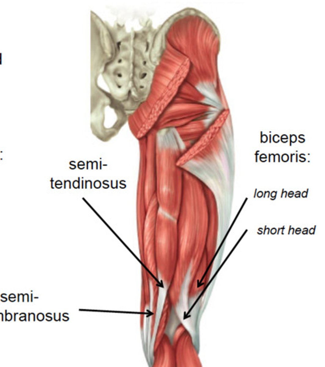 <p>-Sartorius</p><p>-Vastus Intermedius (deep)</p><p>-Rectus femoris</p><p>-Vastus lateralis</p><p>-Vastus medialis</p>