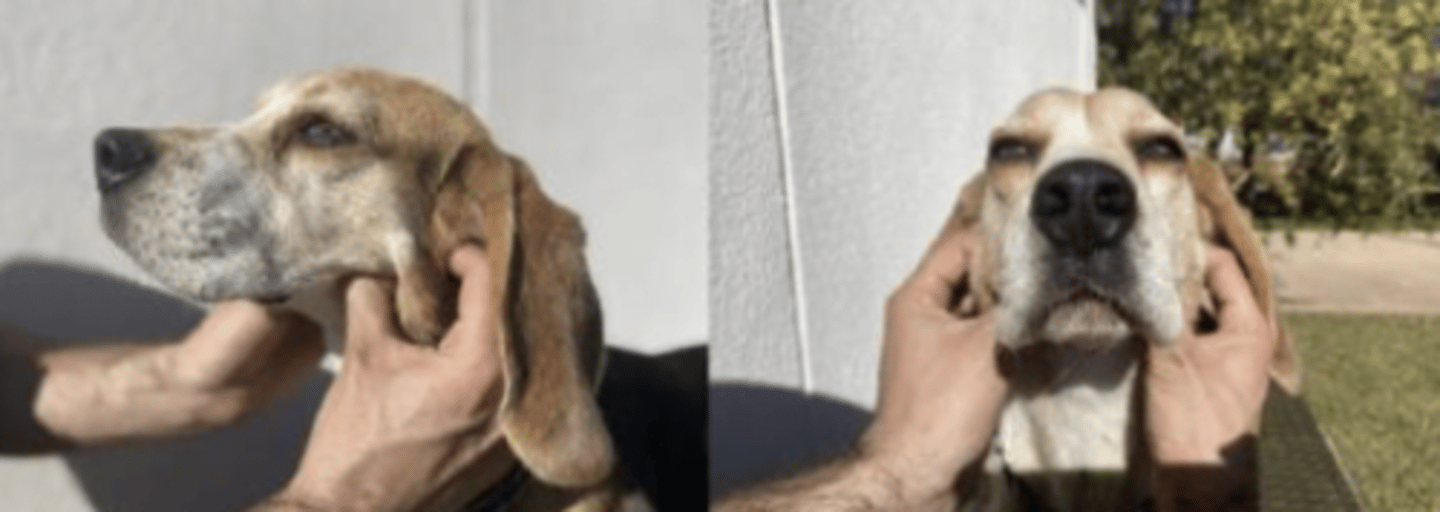 <p>what is being palpated here ?</p>