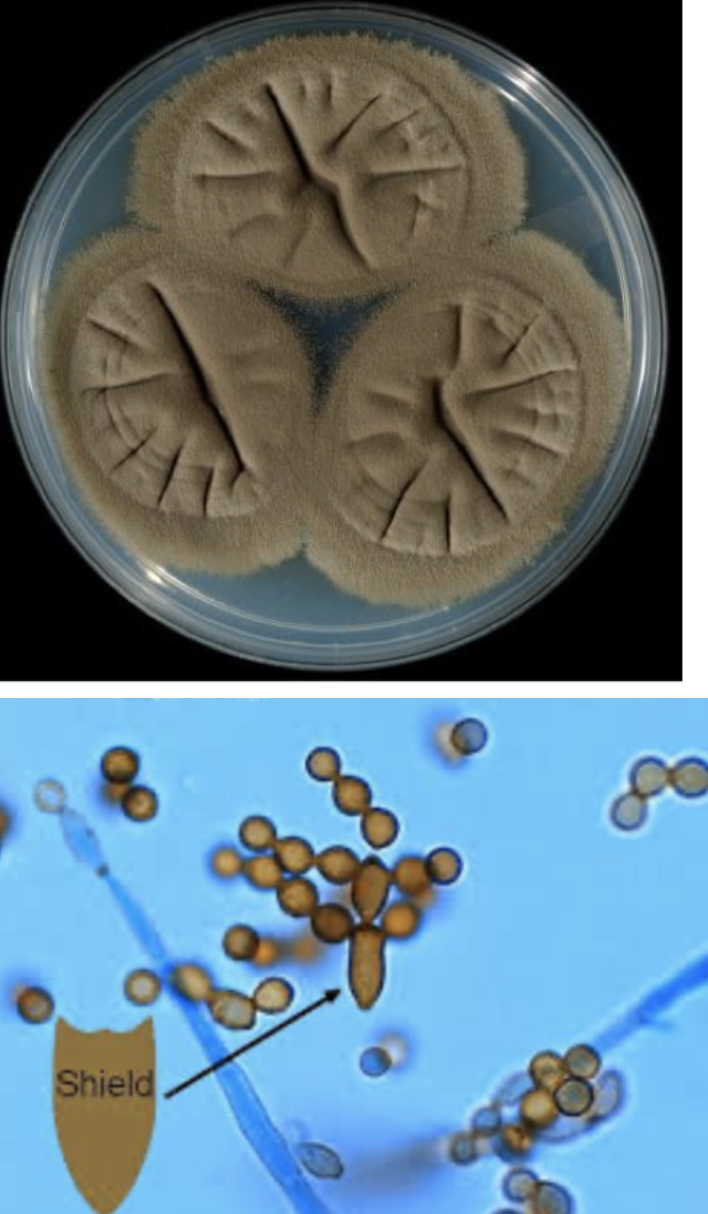 <p>Cladosporium species</p>
