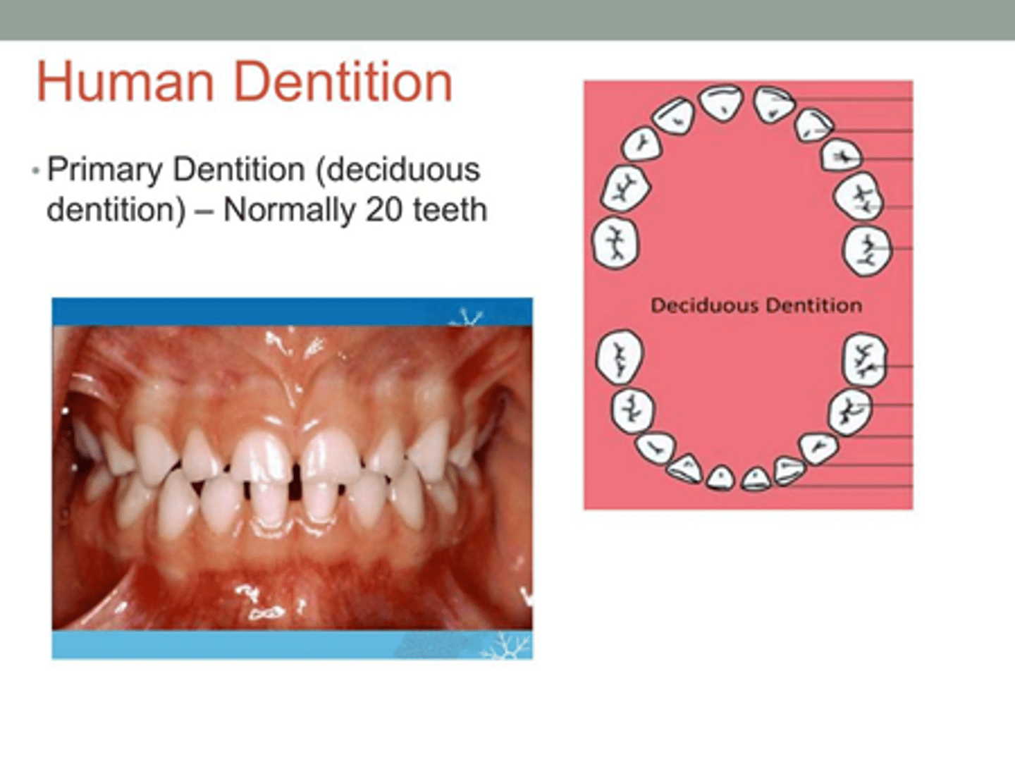 <p>-Primary / deciduous Dentition, we are talking about the entire set of teeth, baby teeth.</p><p>-Primary dentitions are missing all 8 premolars and the 4 wisdom teeth!</p><p>- Incisors = 8</p><p>- Canines = 4</p><p>- Premolars = 0</p><p>- Molars = 8</p><p>TOTAL=20</p>
