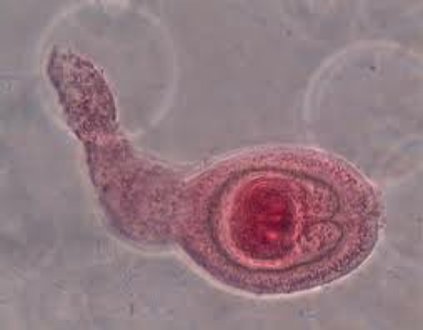 <p>oncosphere</p>