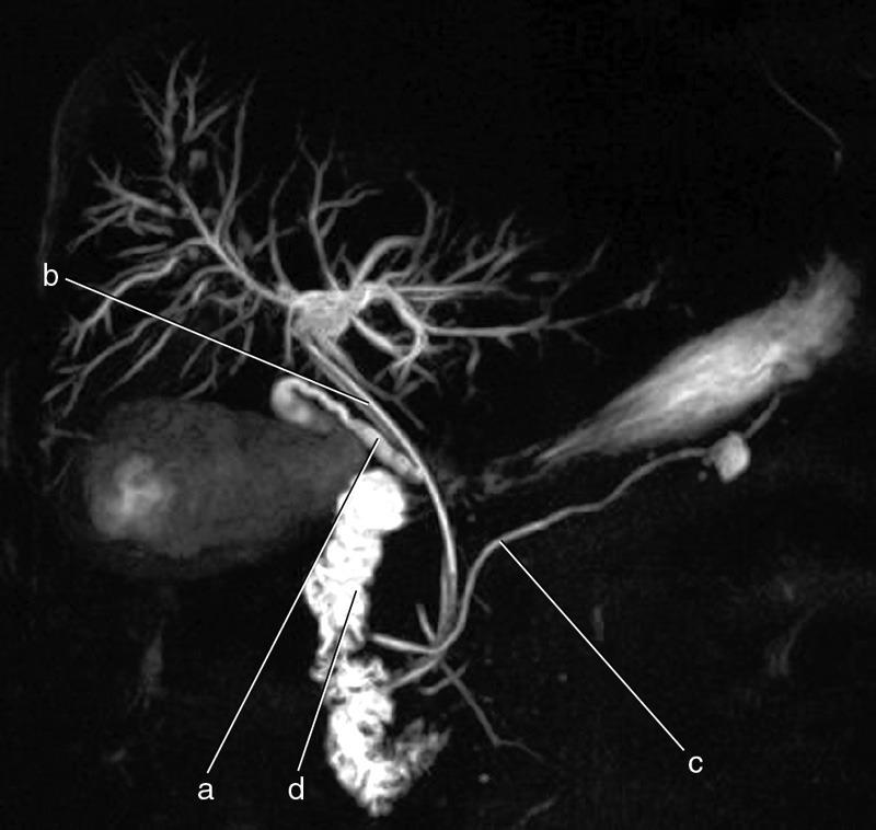 <p><span>Common Hepatic Duct?</span></p>
