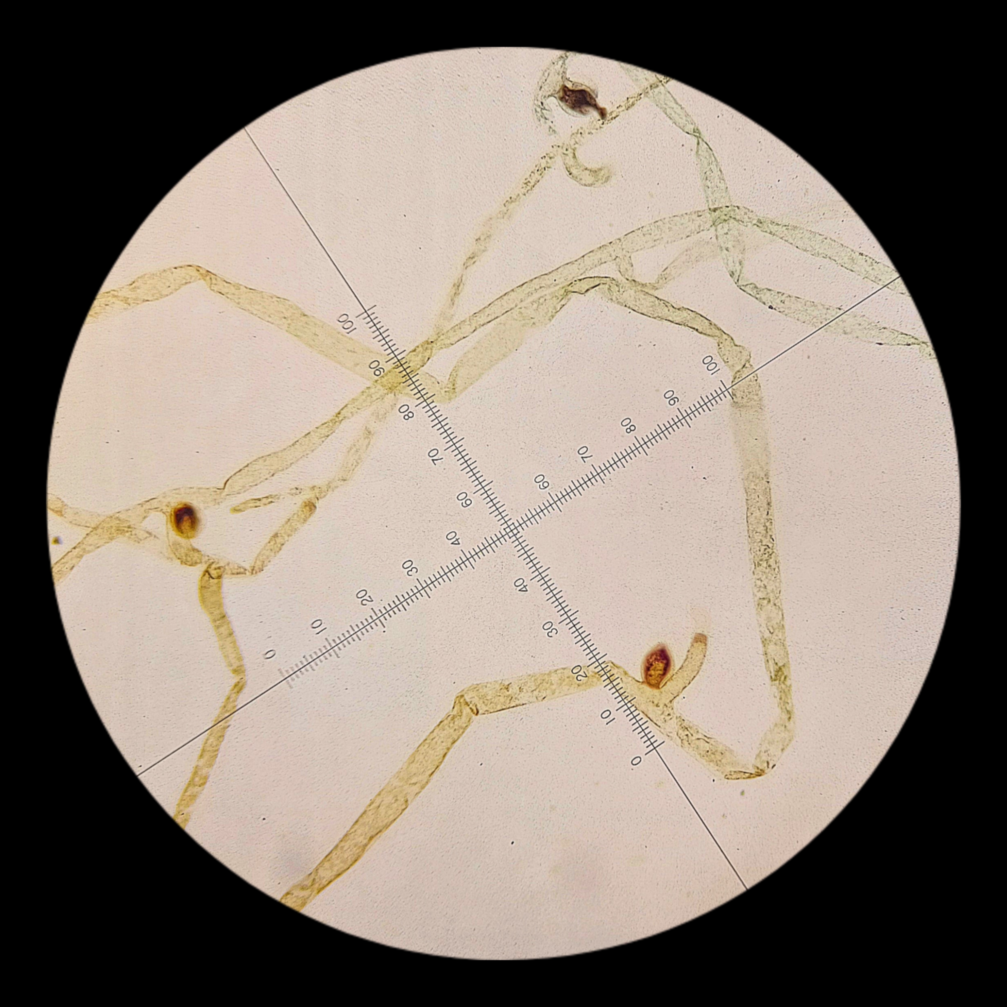 <p><strong><em>Vaucheria</em></strong></p><p><strong>Phylum: ?</strong></p>