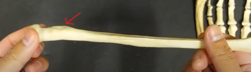 <p>*raised bumpy part </p>