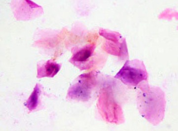 <p><span>•Squamous epithelial cells predominate.</span></p><p><span>       -Some cells may have pyknotic nuclei present while most others will have no nucleus at all.</span></p><p><span>•Abundant bacteria is present.</span></p><p><span>•A few RBCs may be present.</span></p><p><span>•No WBCs are present.</span></p><p>What stage of the estrous cycle is found via the vaginal cytology?</p>