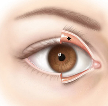 <p>Delicate membrane lining the eyelids and covering the eyeball</p>