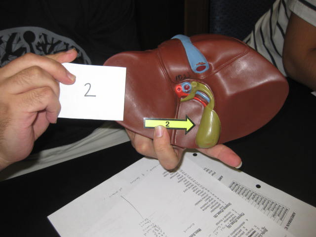 <p>Body Cavities and Body Systems</p><p>Lab Image 1-9</p>