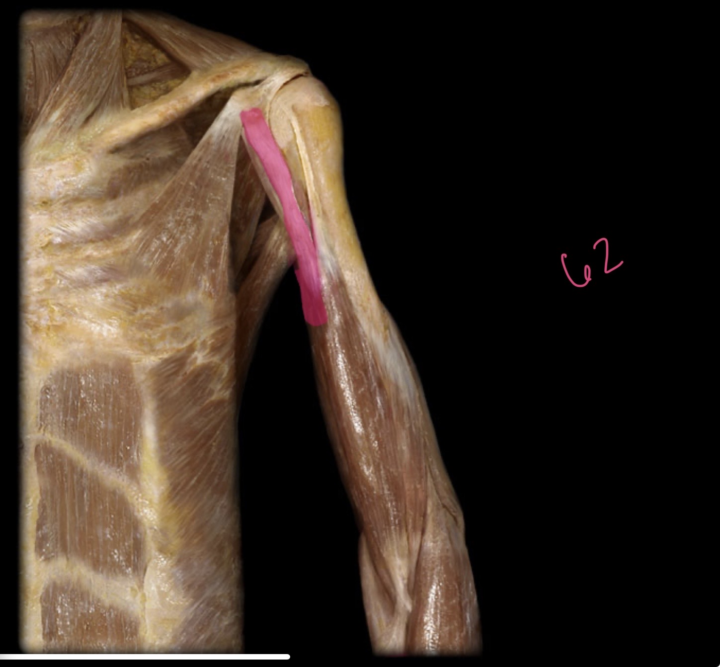 <p>Short head of biceps brachii</p>