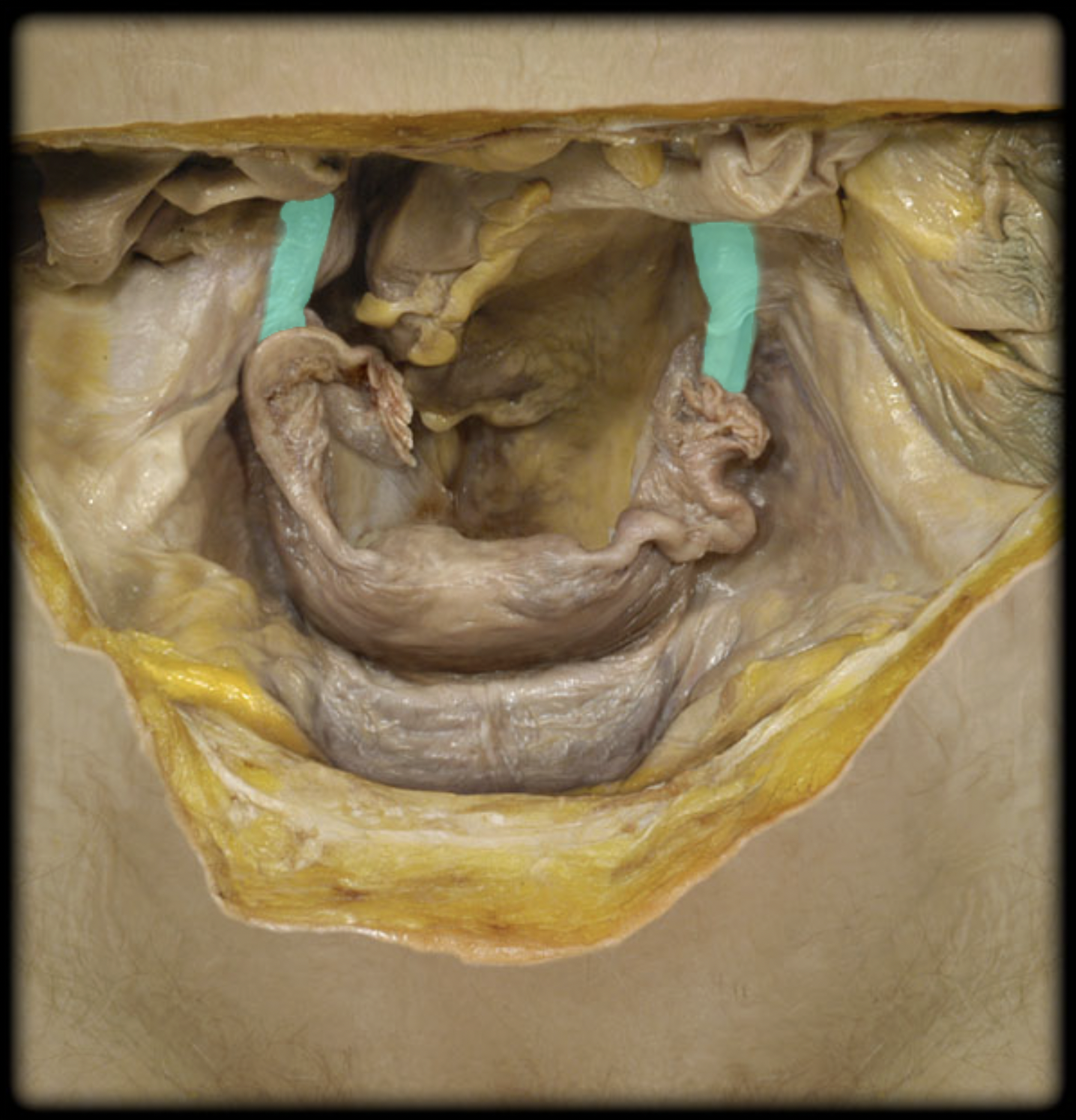 <p>What structure is shown?</p>