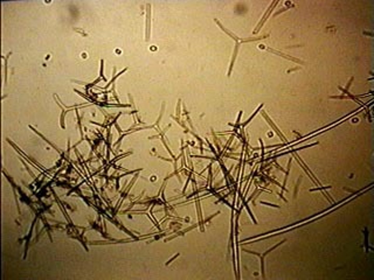 <p>A structure observed in Porifera</p>