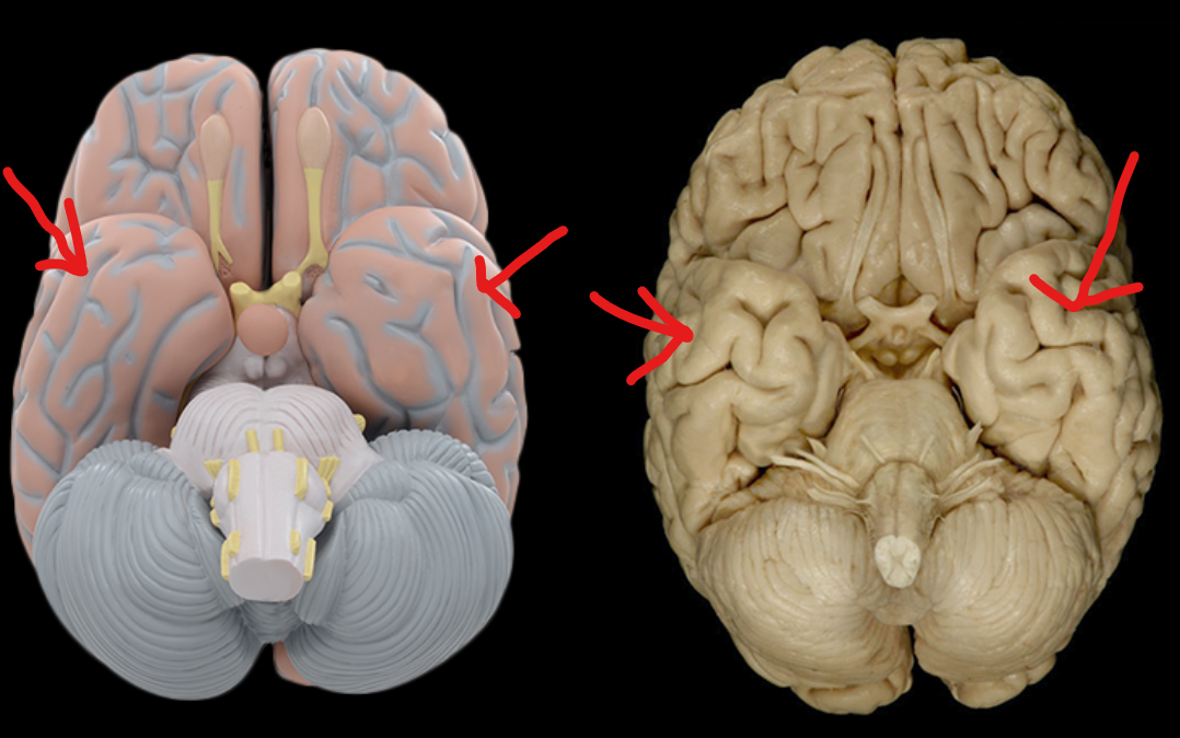 <p>What Lobe is this?</p>