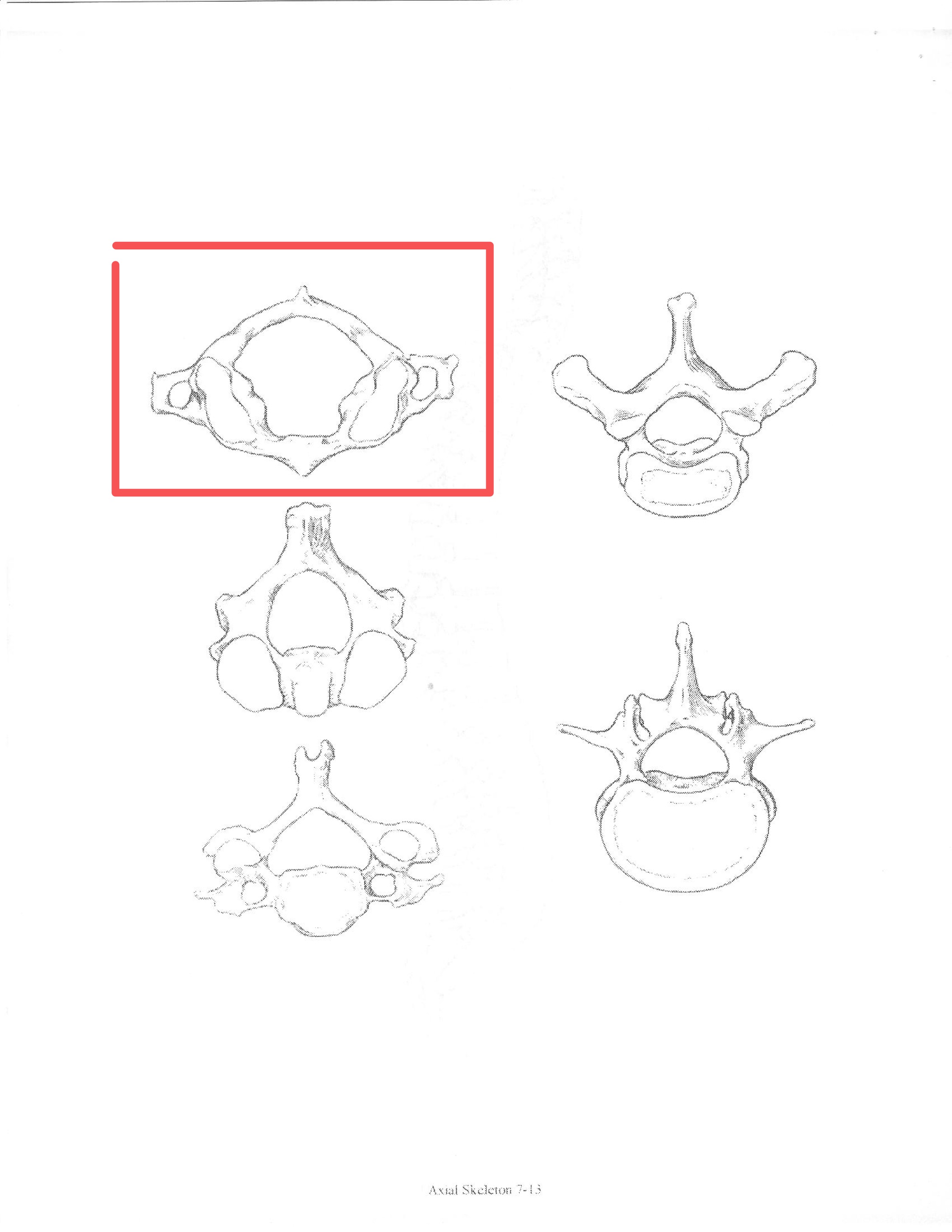 <p>ID bone</p>