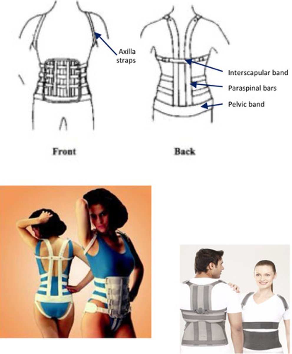 <p>conventional or thermoplastic TLSO</p><p>components: pelvic band, paraspinal bars, interscapular band, axillary straps, corset abdominal support</p><p>biomechanical capacity</p><p>limit FL/EXT (primarily limit thoracic FL)</p>