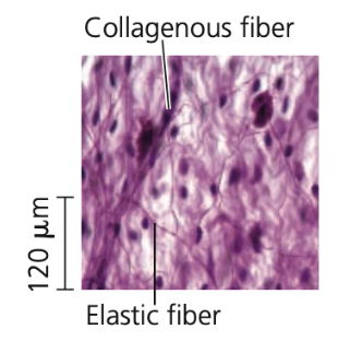 
Loose connective tissue
➔ Most ________ connective tissue in vertebrates
➔ Bind _______ to underlying tissues and holds organs in place
➔ Named after loose weave of its fibers (includes the 3 types)
➔ Found in the skin and throughout the body