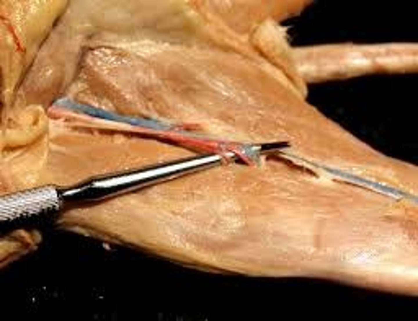 <p>artery of the left arm</p>