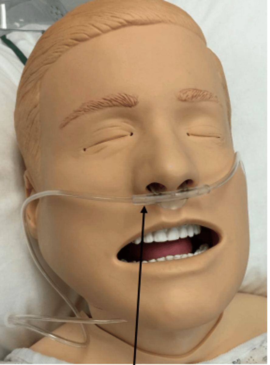 <p>A common oxygen-delivery device in which oxygen flows through two small, tubelike prongs that fit into the patient's nostrils</p>