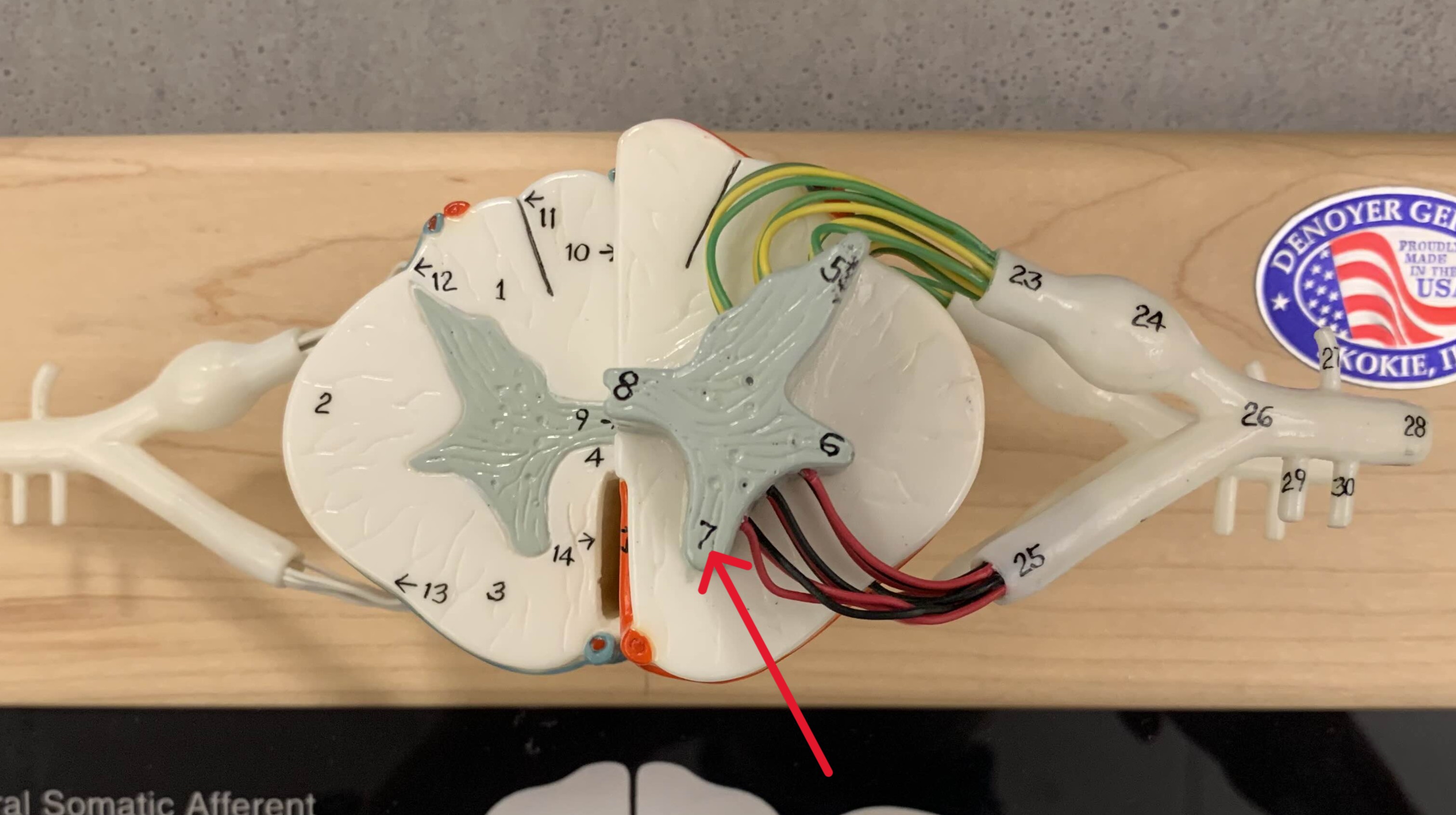 <p>Which gray horn of the spinal cord is:</p><ul><li><p>Gray and on anterior side</p></li><li><p>Contain somatic motor nuclei</p></li></ul><p></p>