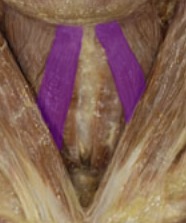 <p>deep to platysma, 2 narrow muscles running up to head, inverted V under chin</p>