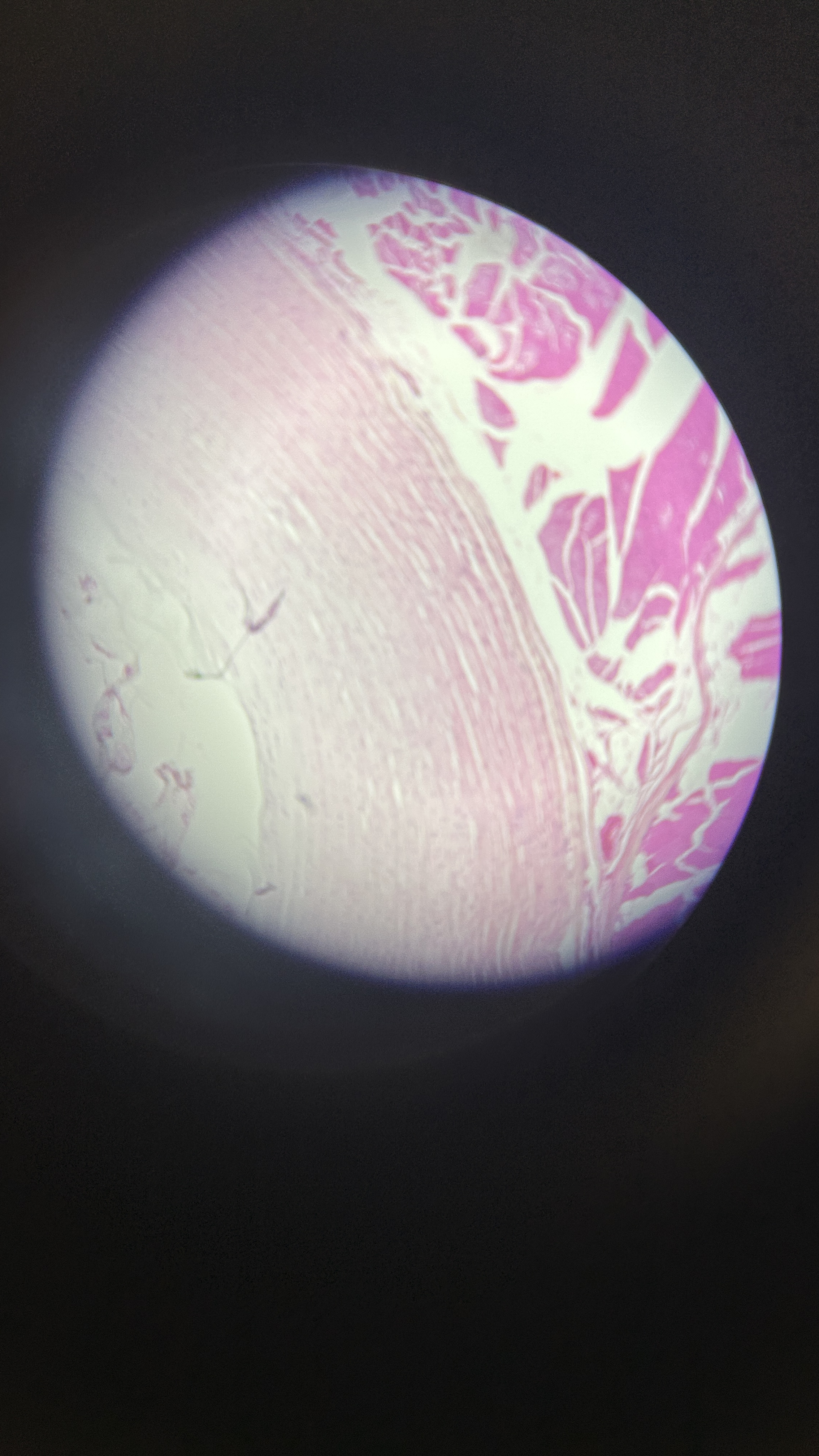 <p>What is the magnification level of the Fibrocartilage?</p>