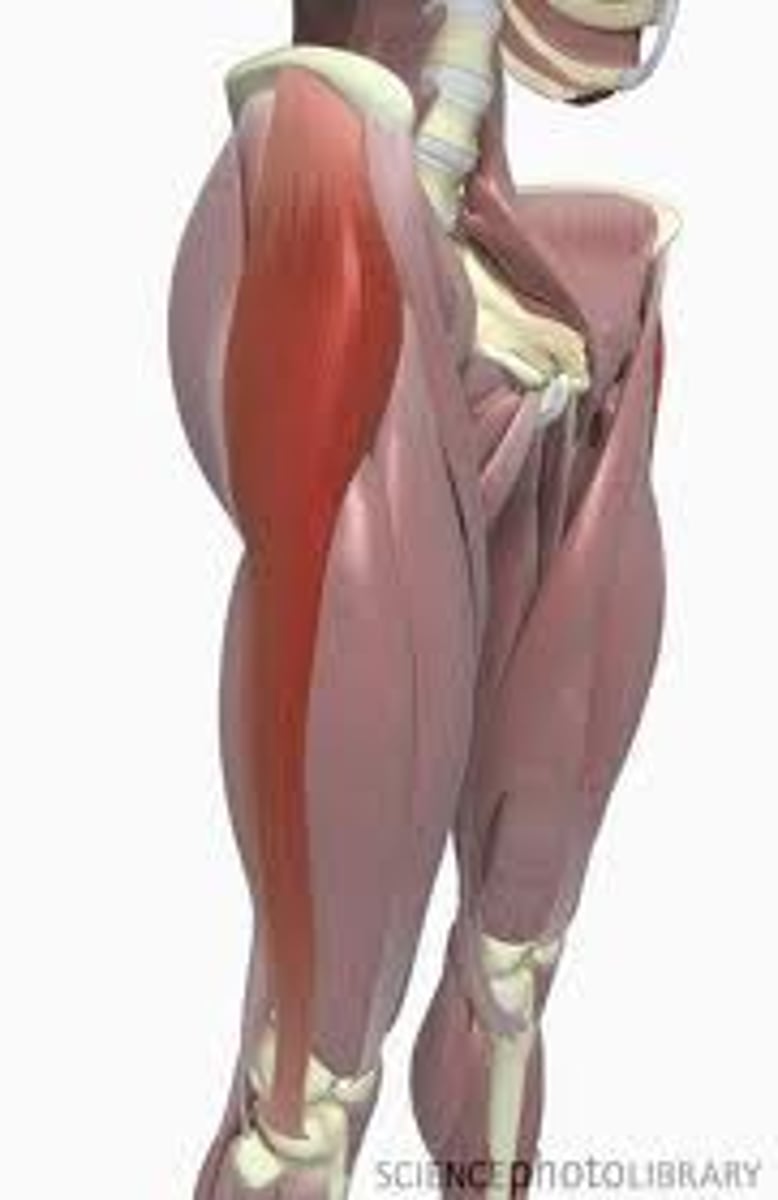 <p>flexes and abducts thigh</p>